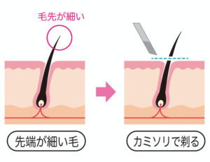 ムダ毛を剃ると毛が太くなるって本当 お肌に負担をかけないムダ毛処理の方法をご紹介 セレブリボーン黒部パッシブタウン プレミア